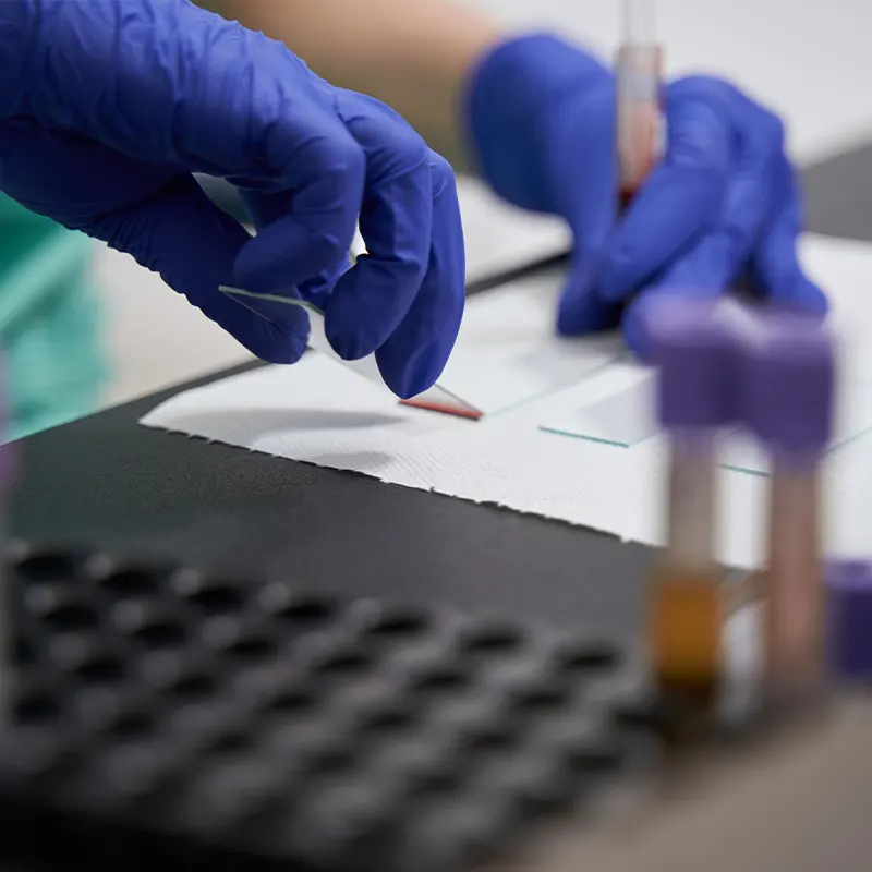 France Gants le choix du nitrile technique de laboratoire France Gants le choix du nitrile technique de laboratoire